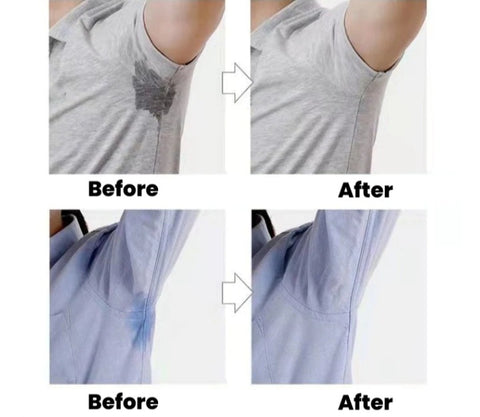 Underarm Sweat Pads (30 Pcs)